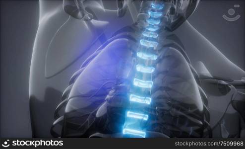 backache in backbone. science anatomy scan of human spine bones glowing. Backache in Back Bones