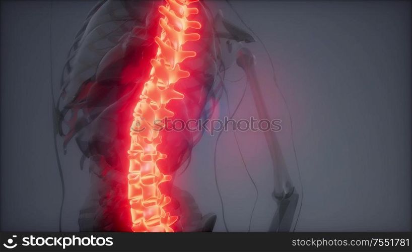 backache in backbone. science anatomy scan of human spine bones glowing. Backache in Back Bones