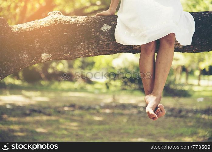 Bare foot female legs sitting on the tree in the park.