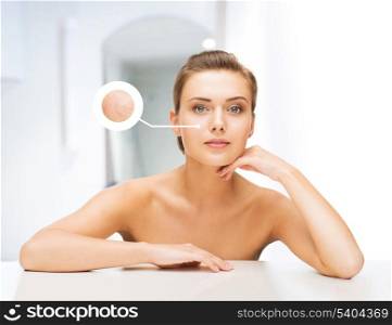 beauty and skin care concept - face of beautiful woman with dry skin examples