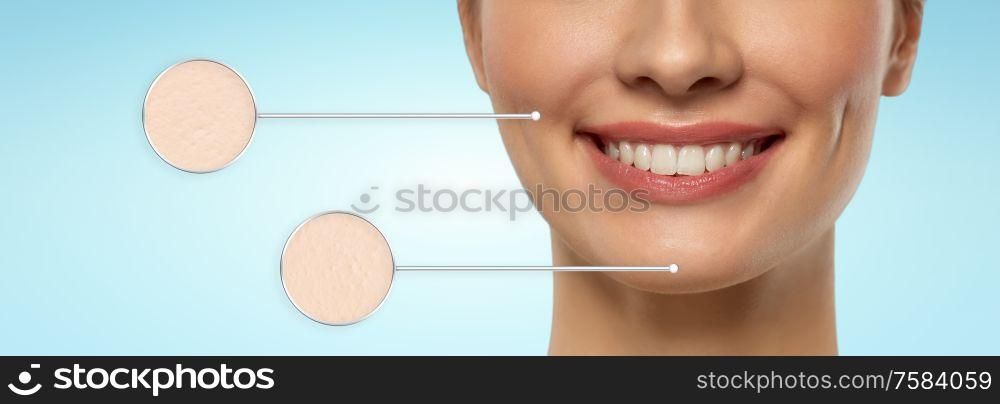 beauty and skincare concept - close up of beautiful young woman face with pointers showing zoomed skin area over blue background. woman face with pointers showing zoomed skin area