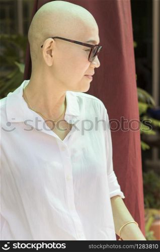 blad head woman after cancer chemical medicine treatment course ,fallsing,hair,ill,sick,patient,glasses,. blad head woman after cancer chemical medicine treatment course