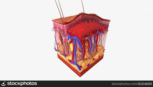 Blood blisters are small pockets of blood that appear in the most superficial layers of the skin. 3D rendering. Blood blisters are small pockets of blood that appear in the most superficial layers of the skin.