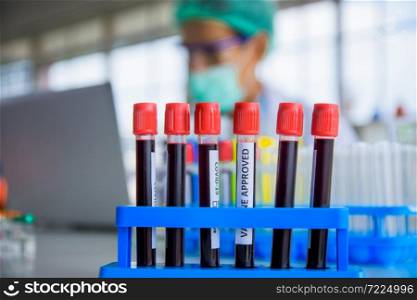 Blood sample research for vaccine corona virus in lab hospital