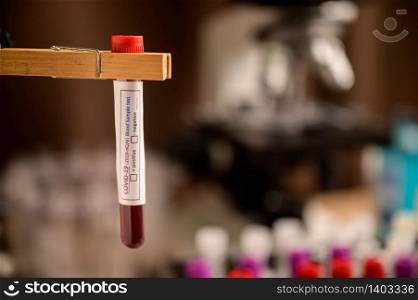 Blood sample test tube for COVID-19 in Laboratory