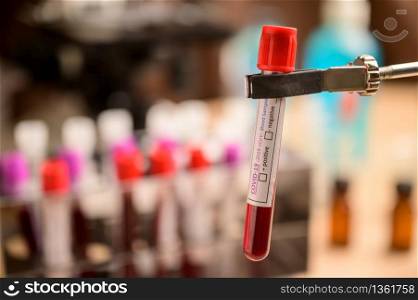 Blood sample test tube for COVID-19 test, novel coronavirus 2019 found in Wuhan, China