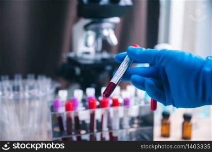 Blood sample test tube for COVID-19 test, novel coronavirus 2019 found in Wuhan, China