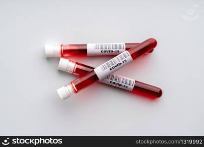 Blood test sample for COVID 19 virus