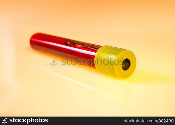 Blood test tube isolated on orange background. Blood test tube