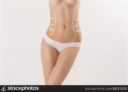 Body correction with the help of plastic surgery on white background. Body correction with the help of plastic surgery on white background. Woman belly marked out for cosmetic surgery or liposuction