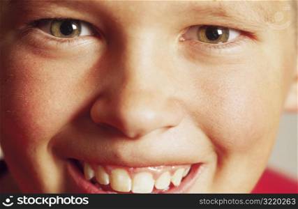 Boy Showing His Teeth