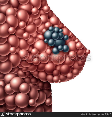 Breast tumor and mammary gland cancer symbol as a cancerous growth symptom and diagnosis on a female anatomy made of abstract spheres with a malignant lump or mass as a 3D illustration.