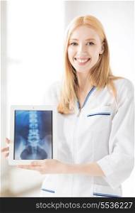 bright picture of female doctor with x-ray on tablet pc