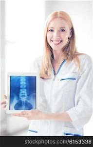 bright picture of female doctor with x-ray on tablet pc. female doctor with x-ray on tablet pc