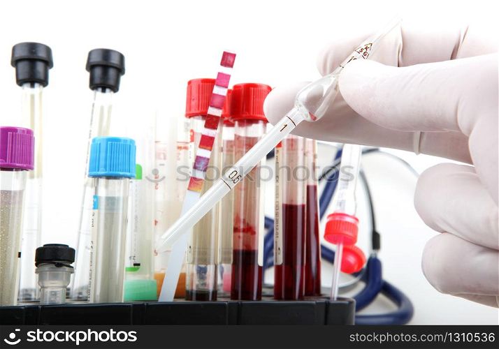 Burgas, Bulgaria - February 03, 2013: Scientist working in his laboratory. Blood test. Regular blood testing is one of the most important ways to keep track of your overall physical well-being.