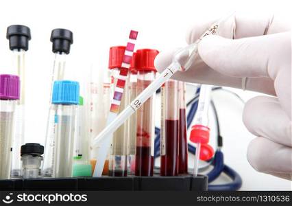 Burgas, Bulgaria - February 03, 2013: Scientist working in his laboratory. Blood test. Regular blood testing is one of the most important ways to keep track of your overall physical well-being.