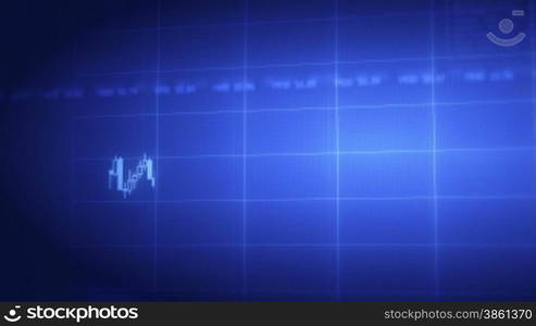 Business CANDLESTICK chart on LCD display projection, with camera following the progression