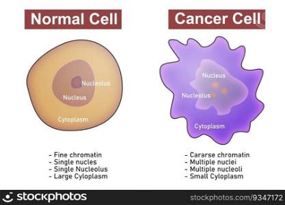 Cancer cell stage and development before after, 3d rendering