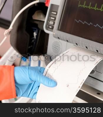 Cardiac monitor printing ekg results monitor tracing pulse