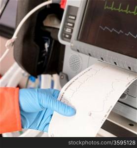 Cardiac monitor printing ekg results monitor tracing pulse