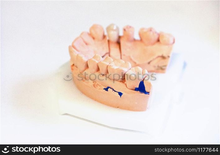 Casts of the jaw. Training at the dentist. Anatomical teeth prints. Education for the orthodontist.. Casts of the jaw. Training at the dentist. Anatomical teeth prints. Education for the orthodontist