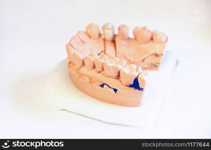 Casts of the jaw. Training at the dentist. Anatomical teeth prints. Education for the orthodontist.. Casts of the jaw. Training at the dentist. Anatomical teeth prints. Education for the orthodontist