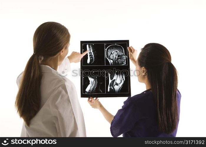 Caucasian and Asian Chinese mid-adult female doctors analyzing x-ray.