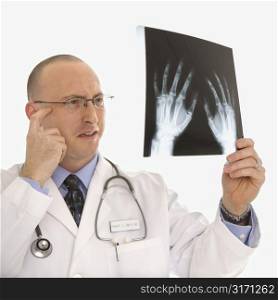 Caucasian mid adult male physician holding up hand xrays looking perplexed.