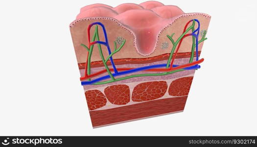 Celiac Disease is a chronic condition characterized an inflammatory allergic response of the digestive tract to Gluten. 3D rendering. Celiac Disease is a chronic condition characterized an inflammatory allergic response of the digestive tract to Gluten.