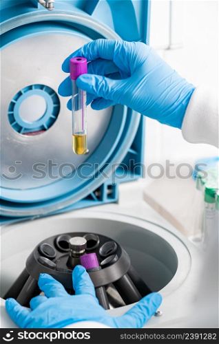Centrifuging sample in a laboratory