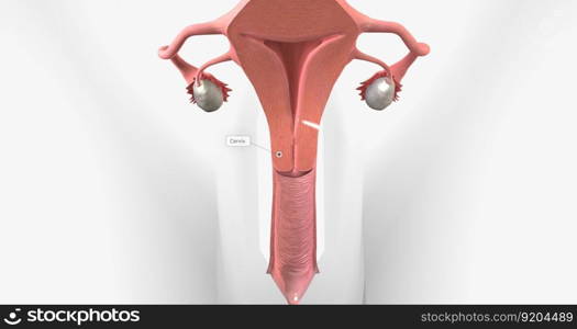 Cervical cancer is a disease that affects the cervix, characterized by tumor growth. 3D rendering. Cervical cancer is a disease that affects the cervix, characterized by tumor growth.