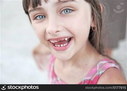 Cheerful girl without teeth