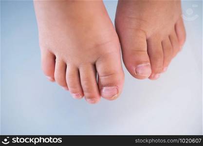 children foot with a cracked and peeling toe nail on the largest toe. Toenail Fungus