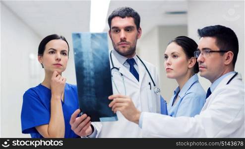 clinic, people, healthcare and medicine concept - group of medics with spine x-ray scan at hospital. group of medics with spine x-ray scan at hospital