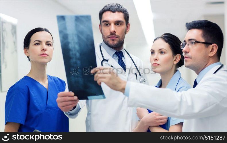 clinic, people, healthcare and medicine concept - group of medics with spine x-ray scan at hospital. group of medics with spine x-ray scan at hospital