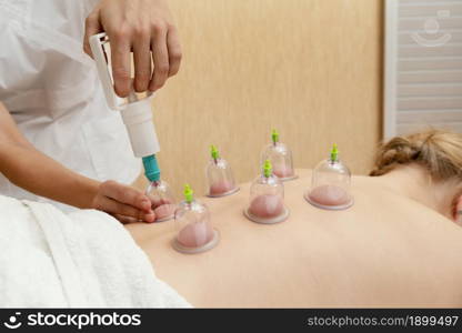 close up cupping therapy experience. Resolution and high quality beautiful photo. close up cupping therapy experience. High quality beautiful photo concept