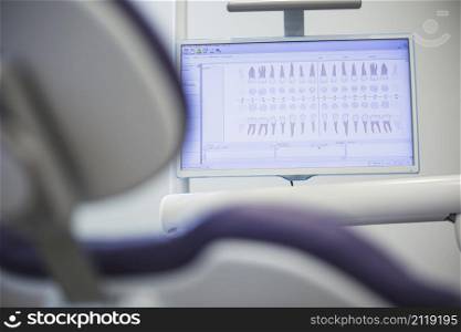 close up dentition chart monitor screen