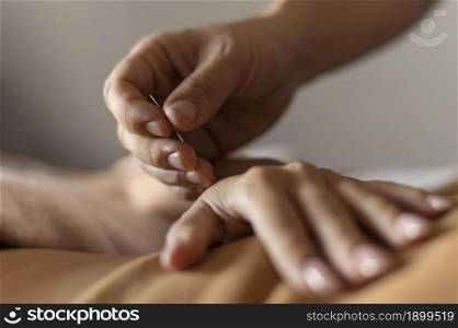 close up hand holding acupuncture needle 2. Resolution and high quality beautiful photo. close up hand holding acupuncture needle 2. High quality beautiful photo concept