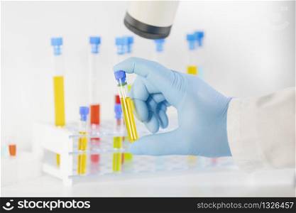 Close-up of a hand in glove holding a glass test tube filled with yellow liquid with out of focus rack with test tubes at the back. Research concept.. Hand holding a glass test tube with yellow liquid