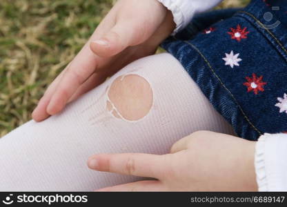 Close up of a little girl&acute;s knee with a hole ripped in her stocking.