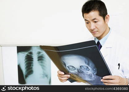 Close-up of a male doctor examining an X-Ray