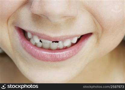 Close-up of a person clenching teeth