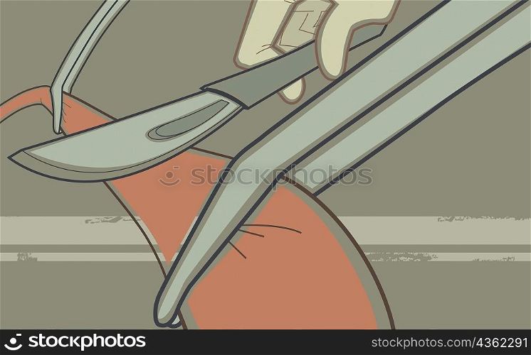 Close-up of a surgeon&acute;s hand cutting human vein with a scalpel