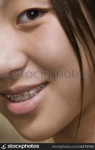 Close-up of a young woman with braces on her teeth