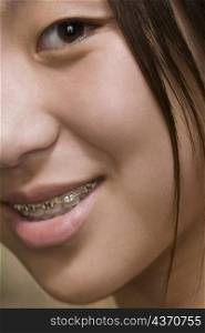 Close-up of a young woman with braces on her teeth