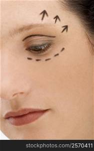 Close-up of a young woman with pre-surgical markings on her face