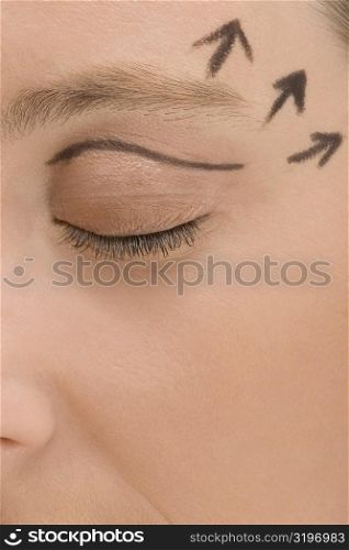 Close-up of a young woman with pre-surgical markings on her face
