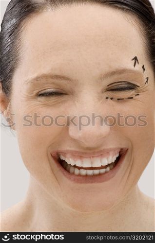 Close-up of a young woman with pre-surgical markings on her face and smiling