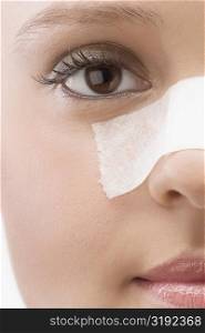 Close-up of an adhesive bandage on a patient&acute;s nose