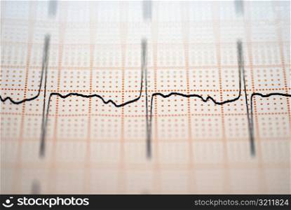 Close-up of an ECG report
